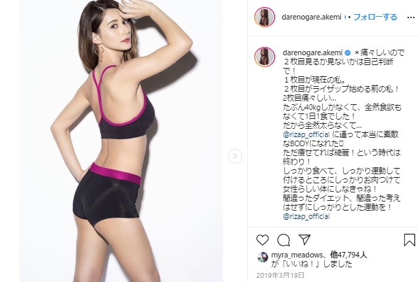 ダレノガレ明美