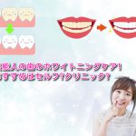 芸能人の歯のホワイトニングケア!おすすめはセルフ?クリニック?